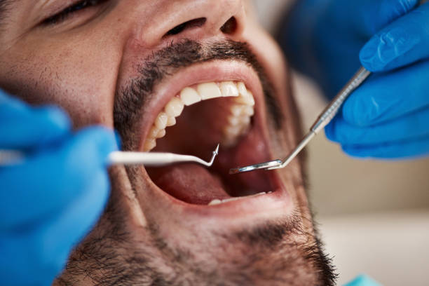 Best Emergency Dental Services for Seniors in Maynardville, TN