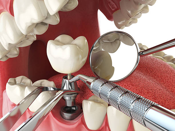 Best Emergency Dentist for Knocked-Out Tooth in Maynardville, TN